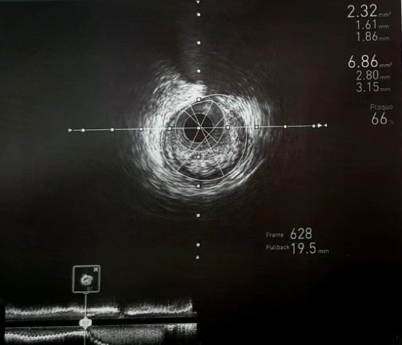1750208605158240.png